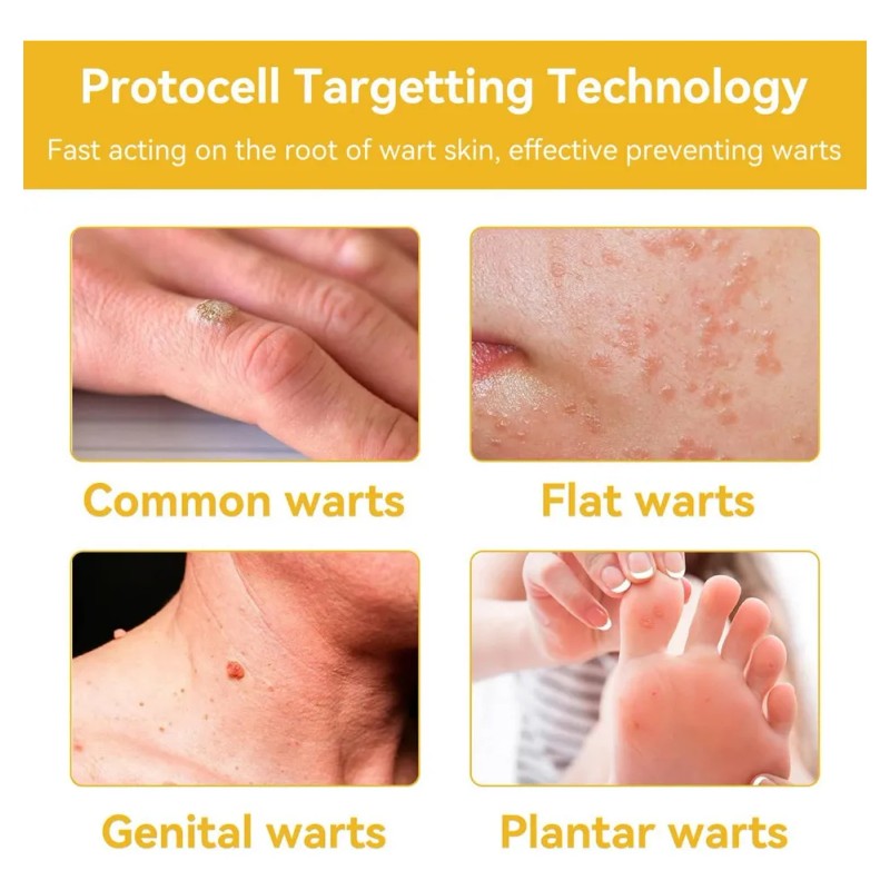 La For Tratamiento De Crema Pltowe Tratamiento De Crema