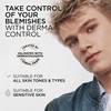 L'Oréal Men Expert Derma Control Anti-Blemish Serum, Smooth & Hydrated