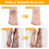 2PCS Crema Hidratante para Pies, Exfoliating Moisturizing Foot Ointment, con