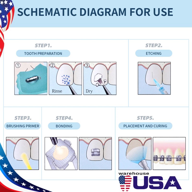 Unbranded Cordless,Denta - Light Cure Composite kit