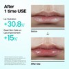 Anua PDRN Lip Serum, Long-lasting Hydration for Dry, Cracked Lips,