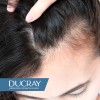 Loción Antí-caída Cabello Ducray Creastim Reactiv Gotero 60ml