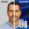 Folcress Xpert Shampoo Anticaída Libre de Sulfatos y Parabenos Grisi