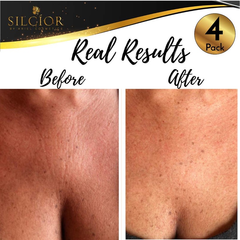 SILCIOR 4 PACK Chest Wrinkle Pads, Silicone Chest Pad, Decollete