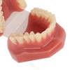 Tooth Model 28 Teeth Dental Orthodontic Model Teaching Study Supplies