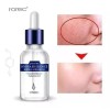 Serum Suero Hidratante Ácido Hialurónico+5 Pza Wonder Patch