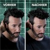 Schauma Anti-dandruff shampoo intensive (400 ml), hair shampoo fights strong