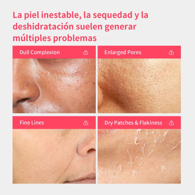 Set Quiyum Rosehip 5 Pzs Cuidado De La Piel Hidratante