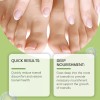 Líquido Para Hongos En Uñas - Cura Hongos Y Onicomicosis