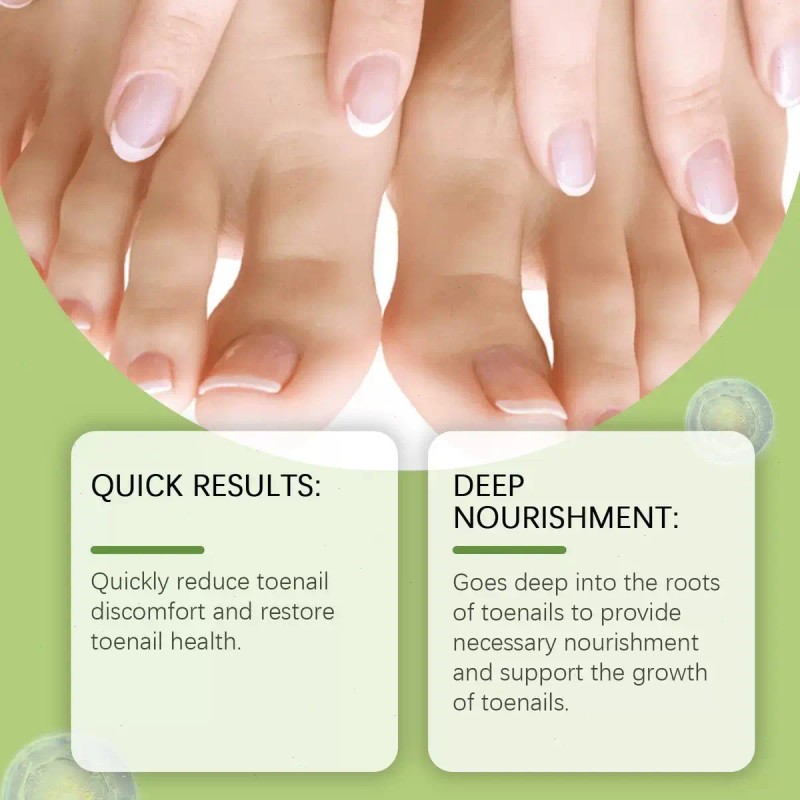 Líquido Para Hongos En Uñas - Cura Hongos Y Onicomicosis