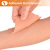 MedEduQuest Burn Wound Packing Trainer, Burn Moulage, Adhesive Skin Burn