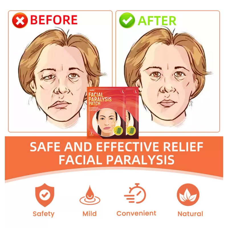 56165156 5×masaje Eficaz For Corregir La Parálisis Facial Con Puntos