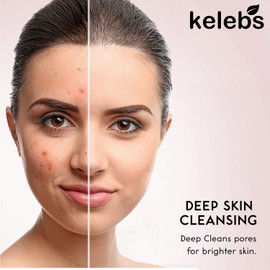 Kelebs 3 Pcs Activated Black Charcoal Soap Bar with Subtle Peppermint Oil Scent. Natural Ingredients - No Plastic