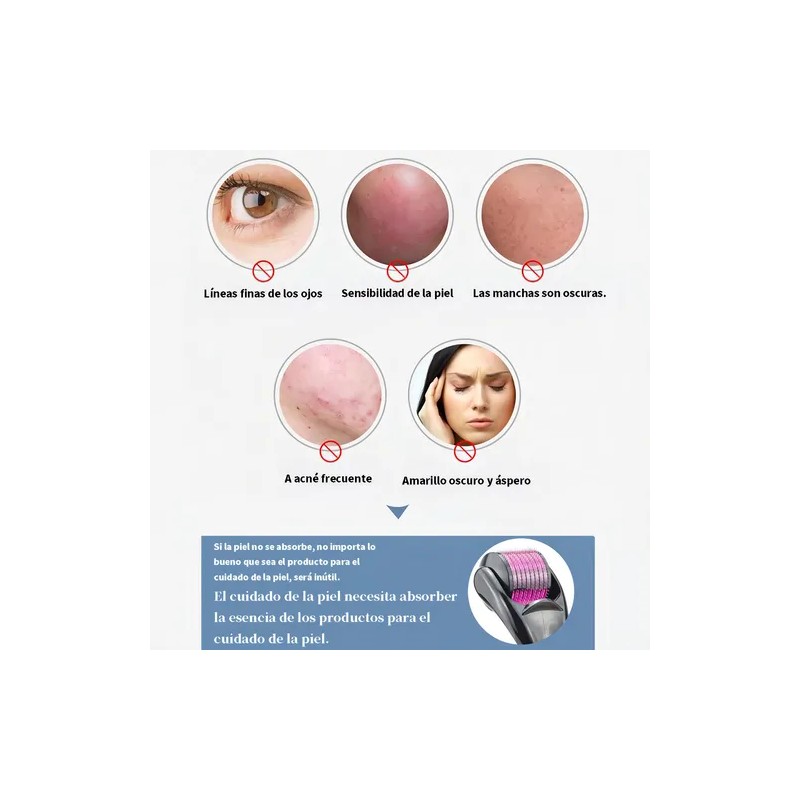 Dermaroller Lynnette Titanio 0.5 mm 540 Agujas Para Rostro