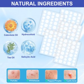 Pimple Patches for Face, 288 Hydrocolloid Acne Patches, Cute Round Shape Zit Covers, Patches for Covering Zits, Colorful Spot Stickers with Tea Tree