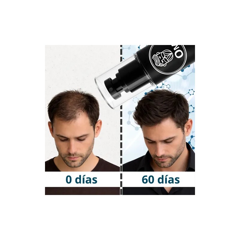 Kit Crecimiento Capilar Anticaida Hair Tonic + Shampoo