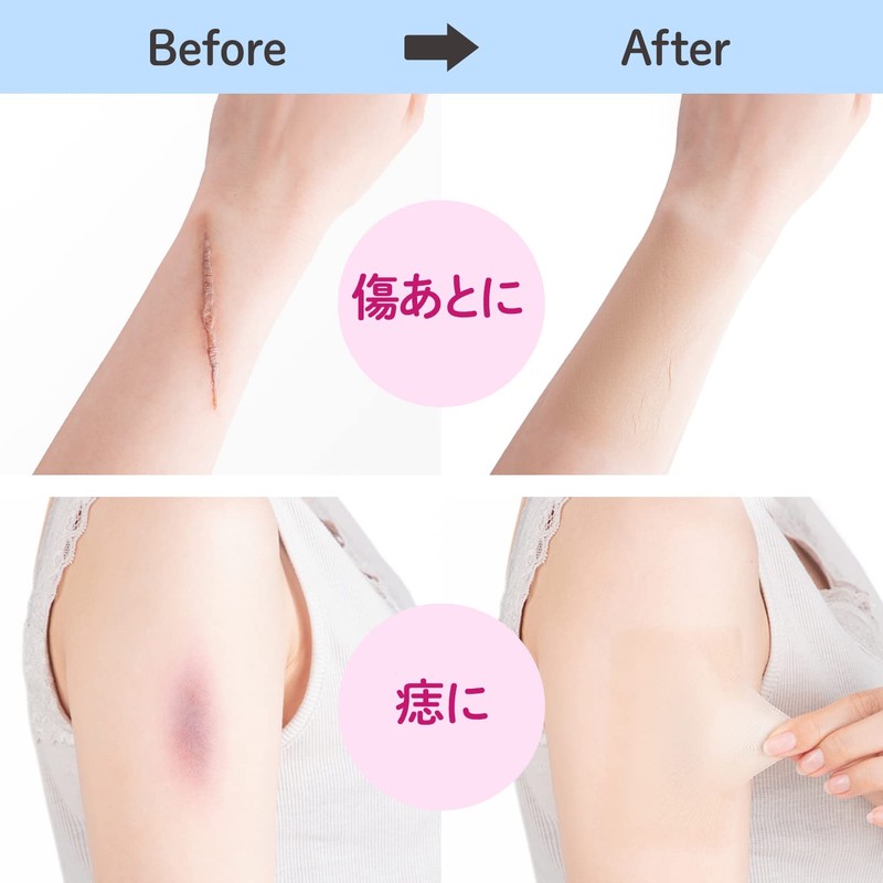 [CLASSE]Seal Concealer, Cover Up tape, Made in Japan, ultra-thin 0.015mm,