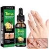 JAYSUING 【Buy 1 Get 1 Free】JAYSUING Ginger Nail CareSerum, Moisturizes,