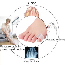 10 Pcs Pinky Toe Splint, Gel Toe Separators, Little Toe Straightener Hammer Toe for Men Women Walking, Running, Overlapping, Bunion Corrector and Bunion Relief