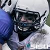 3D Mouth Guard