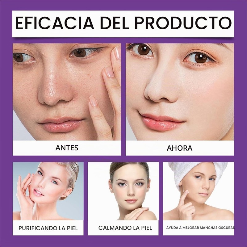 4 Piezas Crema Ácido Azelaico 15% Suero Facial,Sérum para el