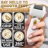 Electric Callus Remover for Feet – 5W Electric Foot Filer,