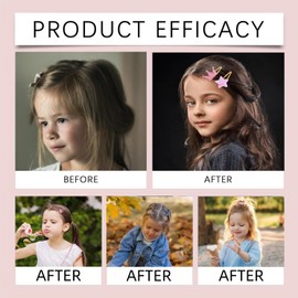 32 Pcs Colorful Baby Girls Hair Accessories,Hair Clips For Girls,Baby Ha-Ir Clips,Multiple Styles To Choose From,Firm,Comfortable,Sp-Arkly Heart,Star,Crown Metal Snap Hair Cl-Ip,For Fine Thick H-Air