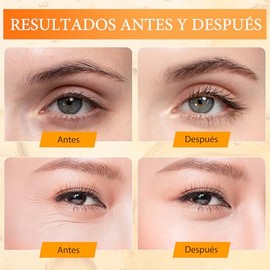 LUSCOR 2PCS Crema para Ojos de papa,Crema de ojos anti-wrinking péptido 5D，Crema para Ojos Peptidos 5D Antiarrugas，Reduce bolsas y ojeras, Repara el c
