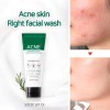 Espuma Limpiadora Some by Mi Miracle Acne Foam 100ml Antiacné