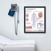 Understanding DVT Deep Vein Thrombosis Framed Medical Educational Informational Poster