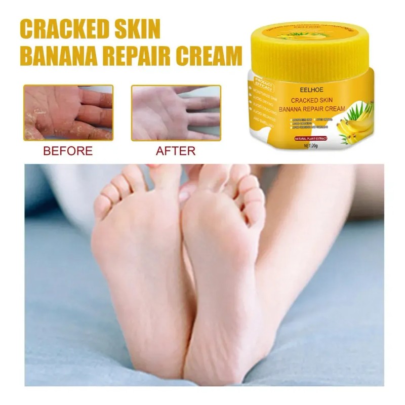 ( Crema Bálsamo For Talones Agrietados For Pieles Secas Y