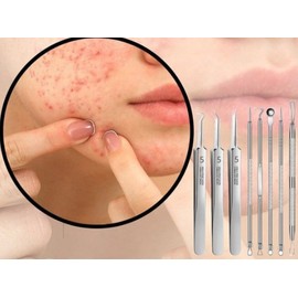 Pyrgasm Blackhead Acne Removal Tweezers Sebum Extrusion Removal Tweezers / 피르가즘 블랙 헤드 여드름 제거 집게 피지 압출 제거 핀셋