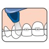 TePe Interspace Angled Medium Toothbrush for Braces with Single-End Tuft