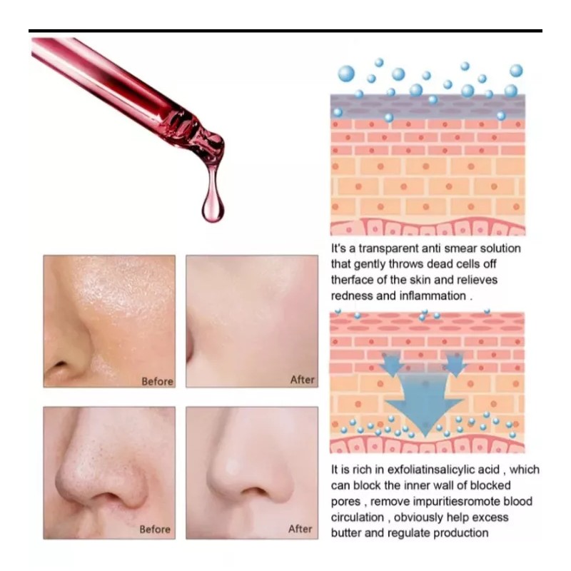 Eelhoe Granactive Retinoid 2% Emulsión 30ml