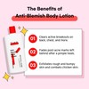 Tiam [Tiam]*renewal* Anti-Blemish Body Lotion 200ml