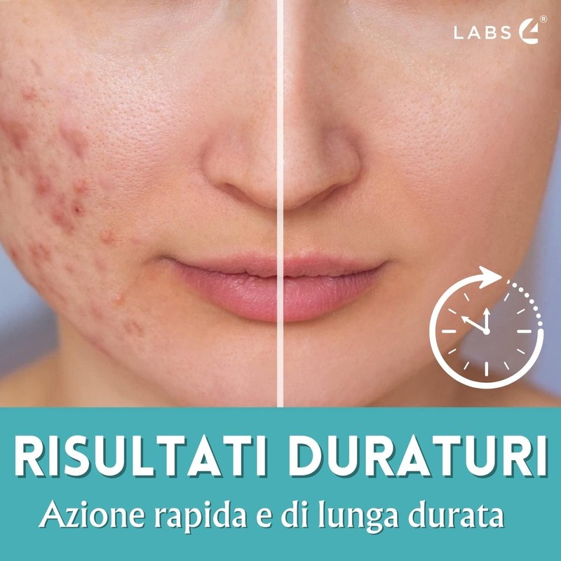 LABS 4 Feel Pure Anti-Akne-Gesichtscreme 30 ml | auf Basis
