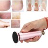 Automatic Electric Foot Grinding Machine Exfoliating Dead Skin Callus Removal
