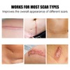 Silicone Scar Sheets 1.6" x 6" Silicone Scar Tape for