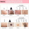 PAKISS FY-103 Beauty Pen for Skin Carecolor: Black, power supply