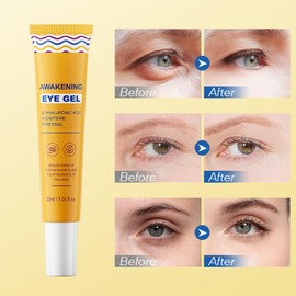 2pcs Wake Up Eye Gel with Caffeine,Retinol Cream&Hyaluronic Acid Serum for Anti-Wrinkle,Dark Circles Removal,Puffy Eye Gel,Eye Puffiness Reducer,Deep Hydrating Eye Cream,Minimize Puffiness&Swelling