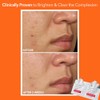 Dr. Dennis Gross Alpha Beta Daily Face Peel, Extra Strength,