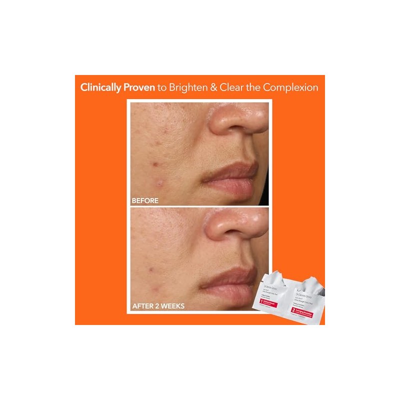 Dr. Dennis Gross Alpha Beta Daily Face Peel, Extra Strength,