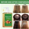 Batana Oil Shampoo, With Shampoo Brush, Hair Growth Shampoos for