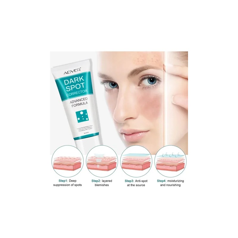 Crema Aclarante Elimina Manchas Piel Exfoliante Facial A