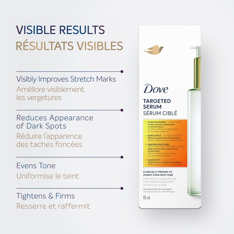 Dove Targeted Stretch Mark Serum: Reduces Dark Spots, Firms &