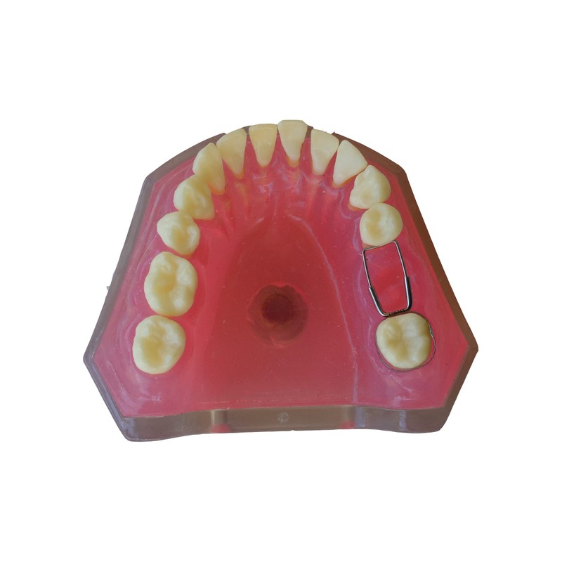 J&J Ortho Preformed Space Maintainer Band & Loop (4/pk) (#34)