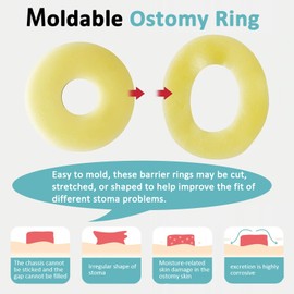 20 Pack Ostomy Barrier Rings, Ostomy Supplies, Moldable Ostomy Rings, Hydrocolloid Skin Barrier Ring for Colostomy Bags