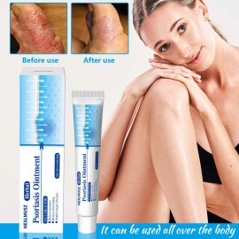 E Crema Externa Para La Piel, Crema, Crema Antipruriginosa,