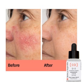 Skincyclopedia Pure Ceramide Face Serum Complex, Anti Aging Intense Hydration, Wrinkle Reducing Barrier Protector, Dark Spot Reduction Vegan & Cruelty Free