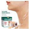 1.5m Parches De Silicona Para Eliminar Cicatrices Cesárea